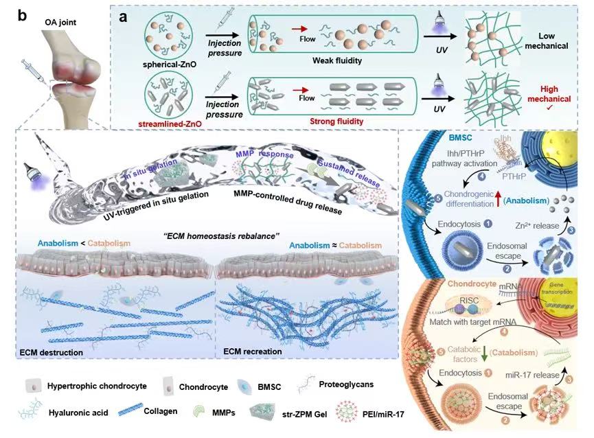 我国科研人员在骨关节炎治疗领域取得新突破